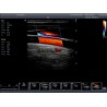 Medical Trolley 4D Color Doppler Sonoscape S11 Ultrasound