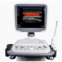 Medical Trolley 4D Color Doppler Sonoscape S11 Ultrasound
