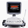 Medical Trolley 4D Color Doppler Sonoscape S11 Ultrasound