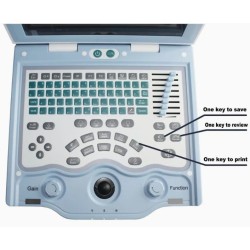 Mini Laptop - 2D Ultrasound Machine