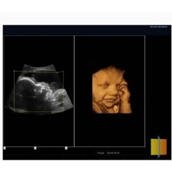 4D Color Doppler Ultrasound Machine-DP-VIV80