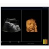 4D Color Doppler Ultrasound Machine-DP-VIV80