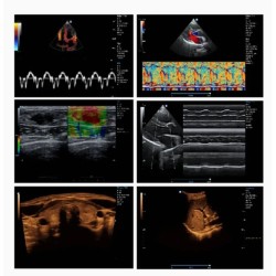4D Color Doppler Ultrasound Machine-DP-VIV80