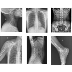 Digital X Ray Machine Analogue 50kw High Frequency X-ray Machine